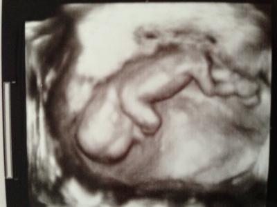 Bild zu Hier noch das erfragte Bild vom Baby :) - Forum für April - Mamis