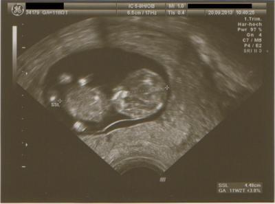 Bild zu FA Termin bei mir auch supi :) - Forum für April - Mamis