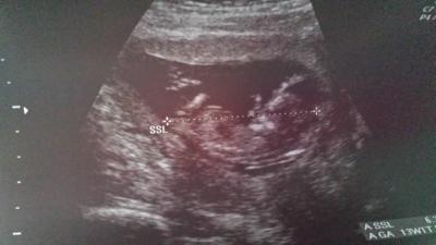 Bild zu bin zurück vom fa - Forum für April - Mamis