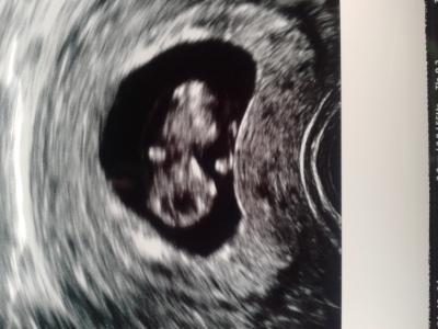 Bild zu Fa Termin - Forum für April - Mamis