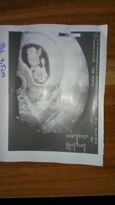 Bild zu zurück vom FA - Forum für April - Mamis