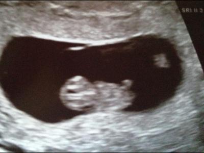 Bild zu Gestern Abend aus dem KH Heim - Forum für April - Mamis