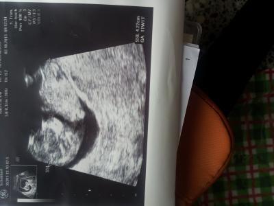 Bild zu zurück vom fa;) - Forum für April - Mamis