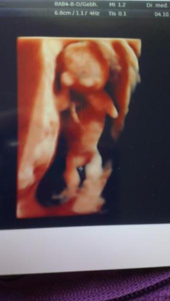 Bild zu wieder da vom FA... - Forum für April - Mamis