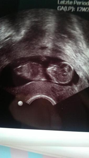 Bild zu Bericht FA - Forum für April - Mamis