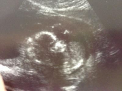 Bild zu FA-Termin - Forum für April - Mamis