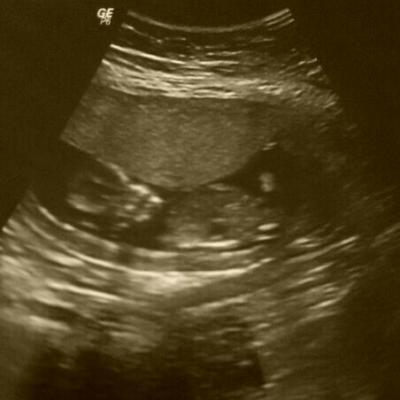 Bild zu Zurück vom FA - Forum für April - Mamis