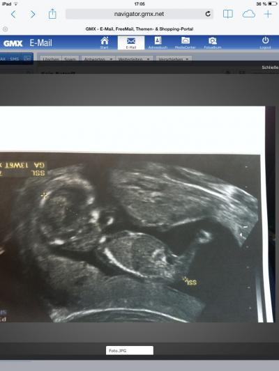 Bild zu Baby gehts gut - Forum für April - Mamis