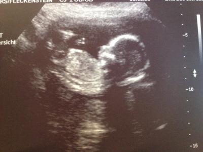 Bild zu Heute FÄ-Termin gehabt! - Forum für April - Mamis