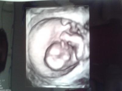 Bild zu Fa Termin - Forum für April - Mamis