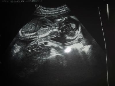 Bild zu FA Besuch - Forum für April - Mamis