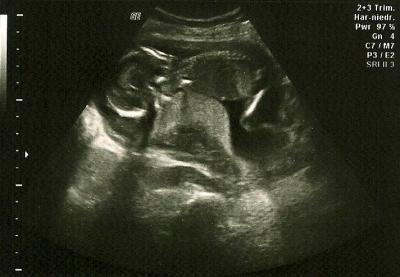 Bild zu FA-Bericht - Forum für April - Mamis