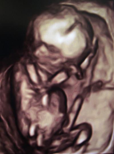 Bild zu War heute auf der Babywelt-Messe + 3D-Bild - Forum für April - Mamis