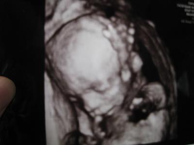 Bild zu FA-US-Outing-schlechter schlaf - Forum für April - Mamis