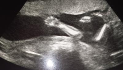 Bild zu US Bild - Forum für April - Mamis