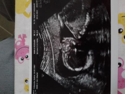 Bild zu ungeplanter Fa Termin - Forum für April - Mamis