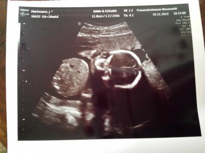 Bild zu Kein Outing - Forum für April - Mamis