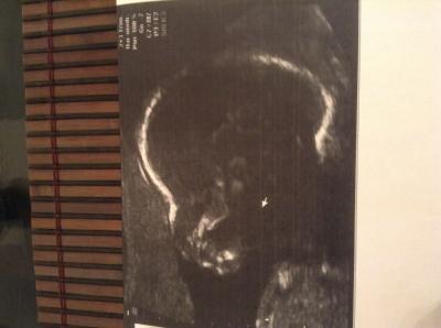 Bild zu FA-Bericht mit Outing - Forum für April - Mamis