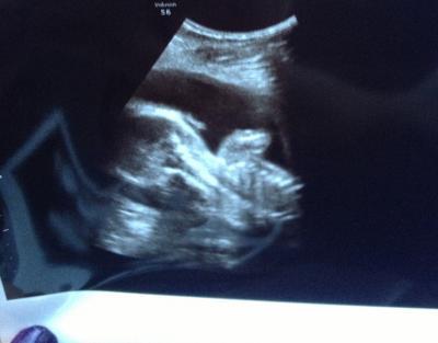 Bild zu Outing und Fa Besuch :) - Forum für April - Mamis