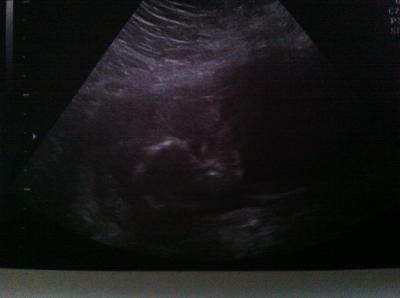 Bild zu Zurück vom FA :) - Forum für April - Mamis