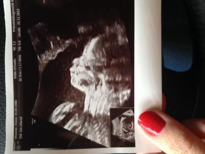 Bild zu Huhuuuu - Forum für April - Mamis