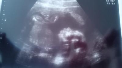 Bild zu Vom Fa zurück - Forum für April - Mamis