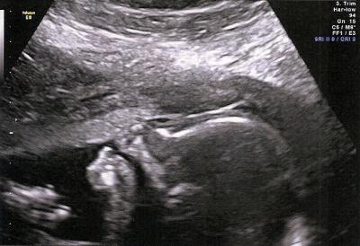 Bild zu Noch ein Organscreening-Bericht - Forum für April - Mamis