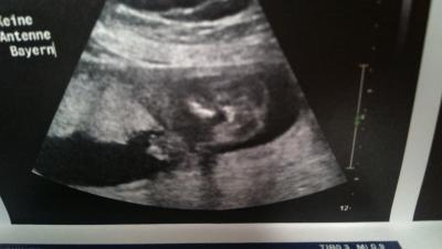 Bild zu Noch 2 Bildchen :) - Forum für April - Mamis