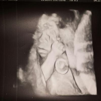 Bild zu organultraschal 3d Bild - Forum für April - Mamis