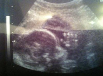 Bild zu FA-Termin und Outing - Forum für April - Mamis