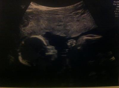 Bild zu FD Ergebnis :) - Forum für April - Mamis