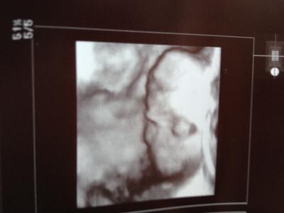 Bild zu 3 D Ultraschall :)) so süß - Forum für April - Mamis