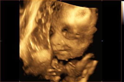 Bild zu Wieder da und 3D-Bilder! :) - Forum für April - Mamis