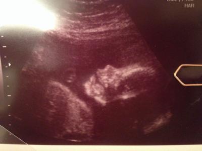 Bild zu Gestern FA-Termin - Forum für April - Mamis