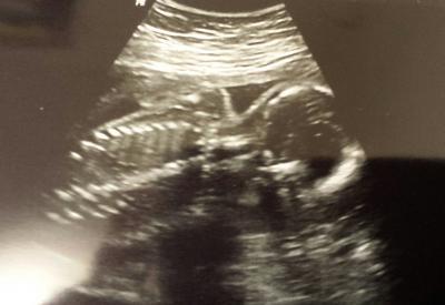 Bild zu FA-Bericht von heute - Forum für April - Mamis