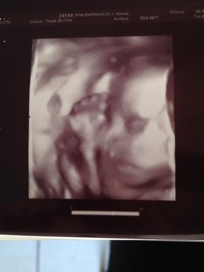 Bild zu 3D Bild bekommen - Forum für April - Mamis