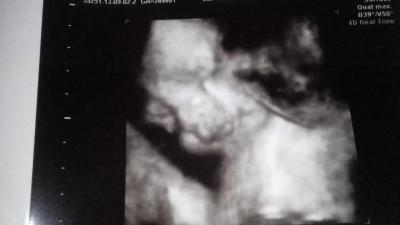 Bild zu FA Besuch - Forum für April - Mamis