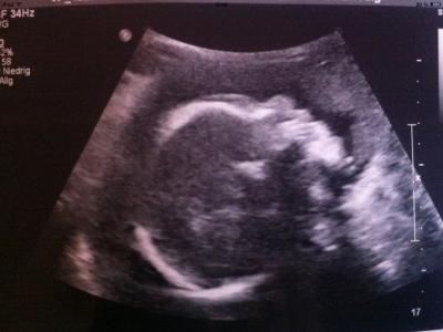 Bild zu Huhu bis wieder da :) und @bibi&spreemädchen - Forum für April - Mamis