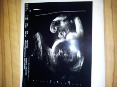 Bild zu Auch vom 3 grossen Screening zurück :-) - Forum für April - Mamis