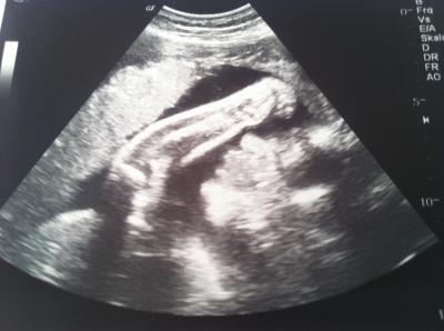 Bild zu Sehr glücklich zurück vom FA - Forum für April - Mamis