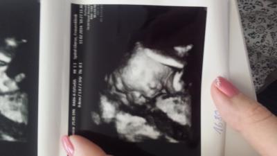 Bild zu zurück vom Frauenarzt - Forum für April - Mamis