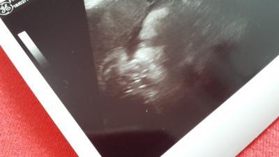 Bild zu Bericht vom FA - Forum für April - Mamis