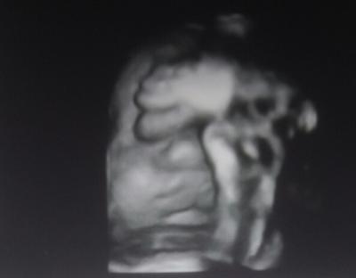 Bild zu Ergebnisse Doppler und lustiges BIld - Forum für April - Mamis