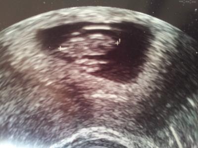 Bild zu jipppi ostern kann kommen - Forum für April - Mamis