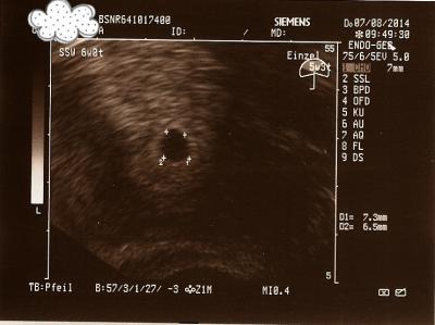 Bild zu Ein schönerer FA-Termin :-) - Forum für April - Mamis
