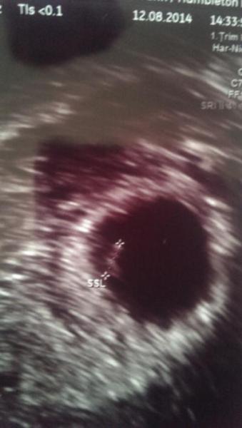 Bild zu so zurück - Forum für April - Mamis