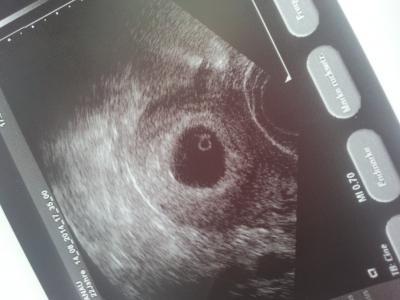 Bild zu Sehr erleichtert! - Forum für April - Mamis