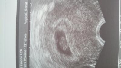 Bild zu Meine Bohne - Forum für April - Mamis