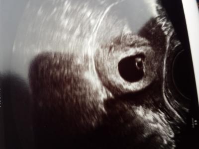 Bild zu zurück vom Fa - Forum für April - Mamis