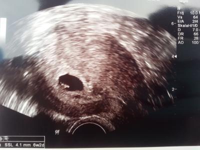 Bild zu das warten hat ein Ende :) - Forum für April - Mamis